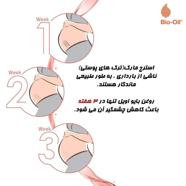 bio oil 125ml 3 1