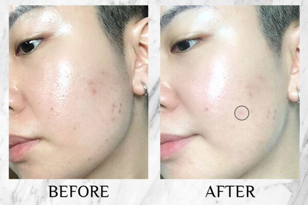 Clinique Even Better Clinical Radical Dark Spot Corrector Interrupter review before after