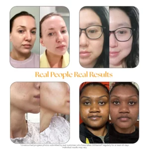 skinbefore after