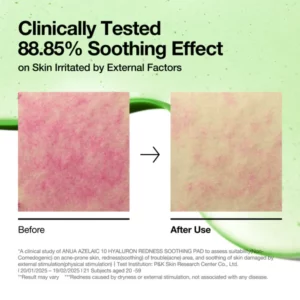 پد آزلائیک اسید آنوا ضدقرمزی Anua Azelaic 10 Hyaluron Redness Soothing pad 12 anua us toner 90 ea azelaic 10 hyaluron redness soothing pad 1170826121