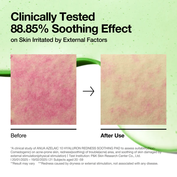 پد آزلائیک اسید آنوا ضدقرمزی Anua Azelaic 10 Hyaluron Redness Soothing pad 4 پد آزلائیک اسید آنوا ضدقرمزی  Anua Azelaic 10 Hyaluron Redness Soothing pad - Image 4